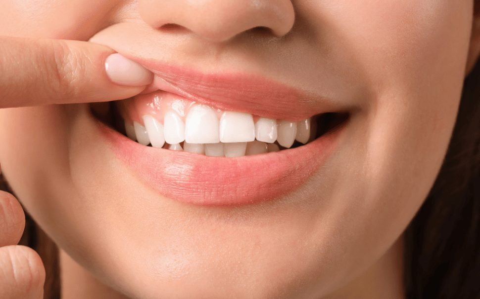  Types of Fillings 