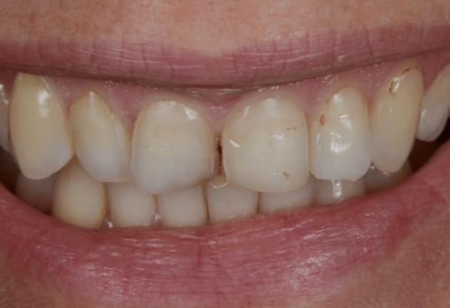 Before - Pearl Dental Care