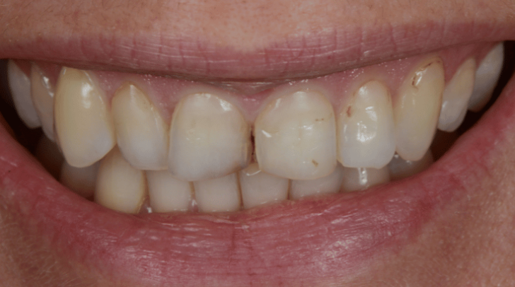 Before - Pearl Dental Care