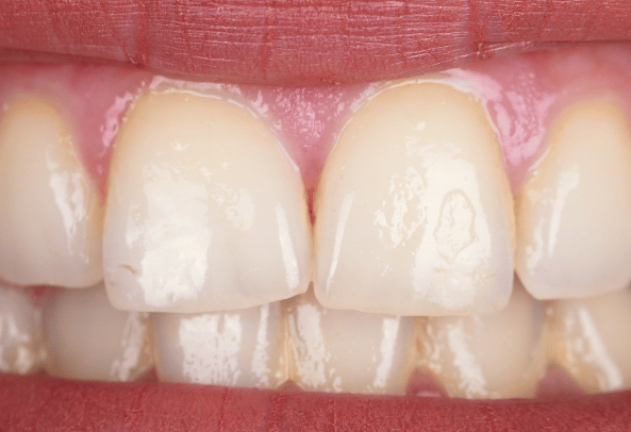 Before - Pearl Dental Care