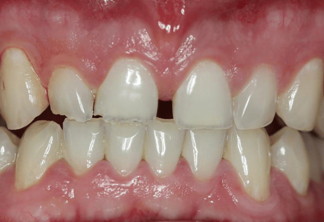 Before - Pearl Dental Care