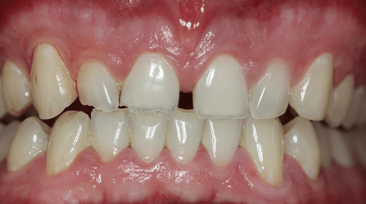 Before - Pearl Dental Care