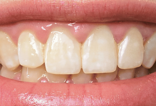 Before - Pearl Dental Care