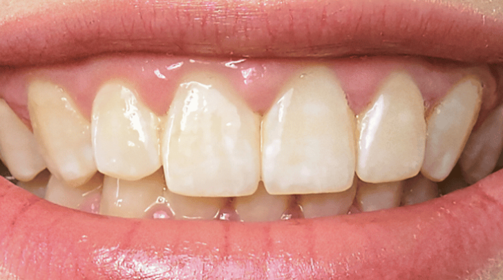 Before - Pearl Dental Care